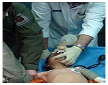 A worker’s hand amputated during working hours