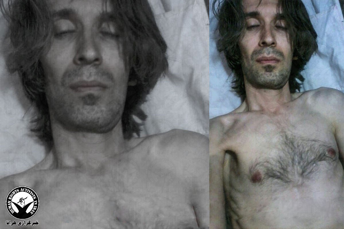 Prison Authorities Withhold Medical Care from an Ailing Arash Sadeghi
