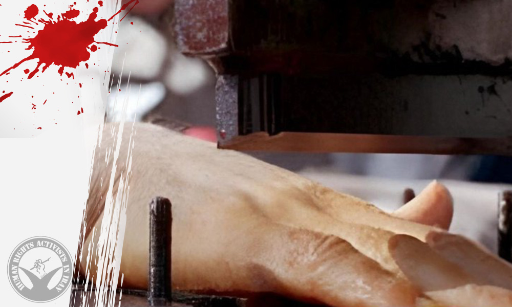 Amputation Sentences for Two Theft Defendants Carried Out in Dastgerd Prison, Isfahan