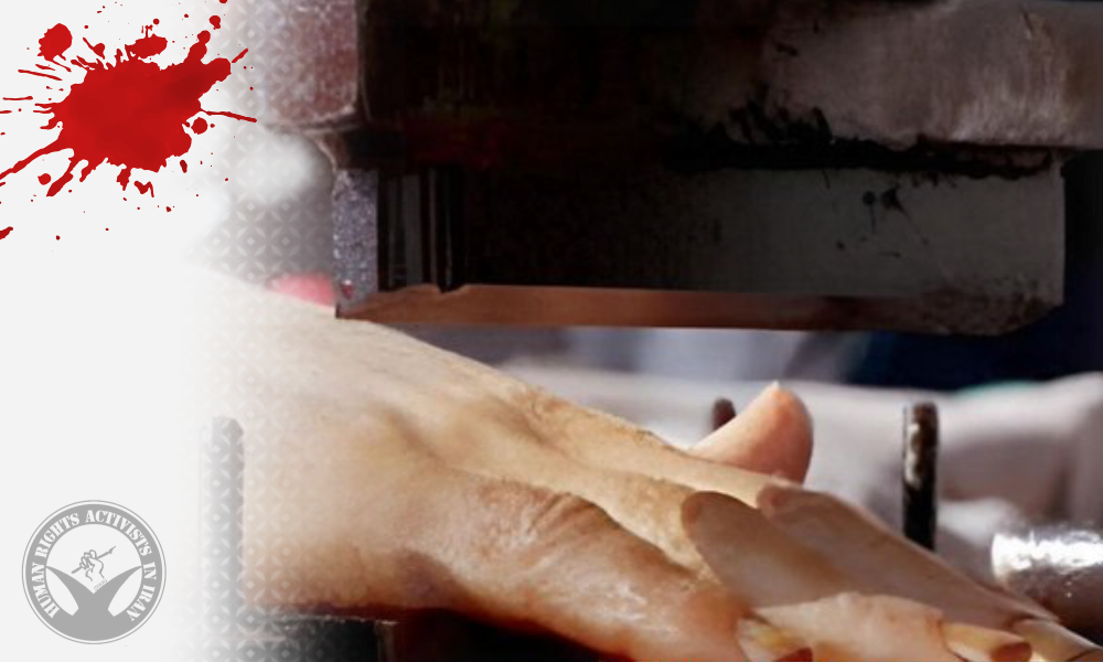 Amputation Sentences Carried Out for Three Inmates in Urmia Prison